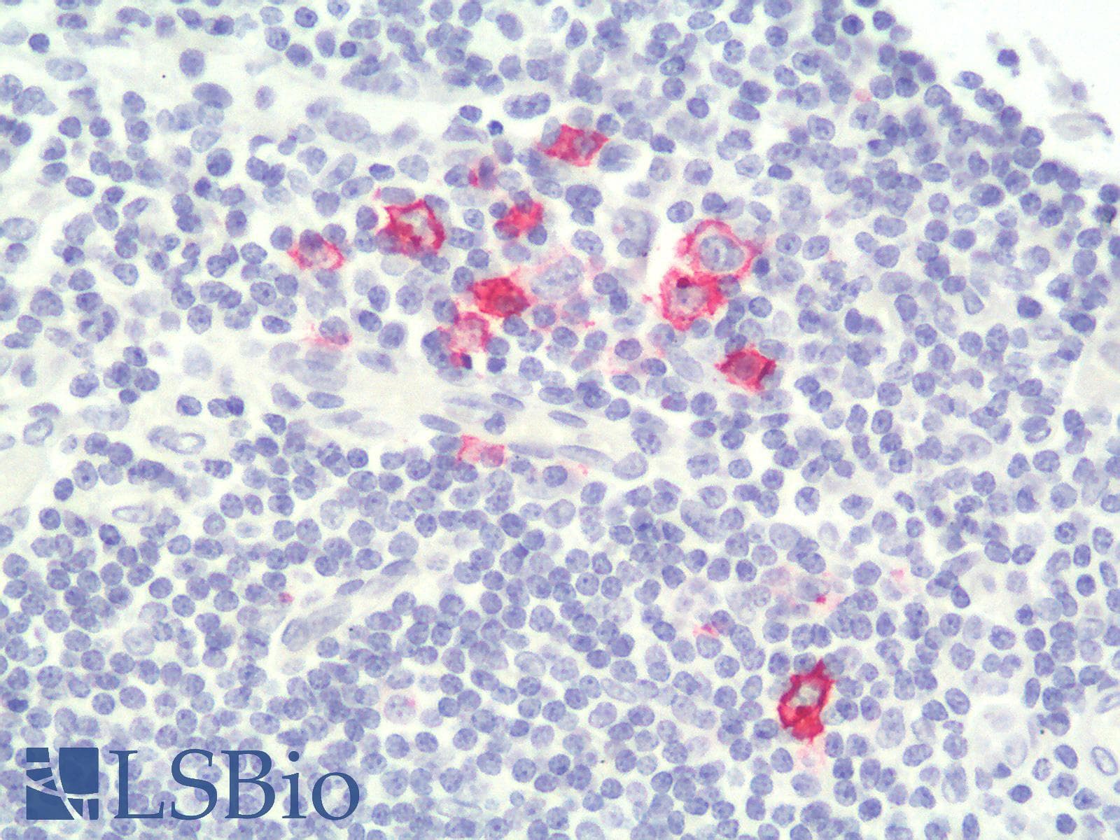 IHC-plus™ CD30 Antibody (clone rCD30/412)