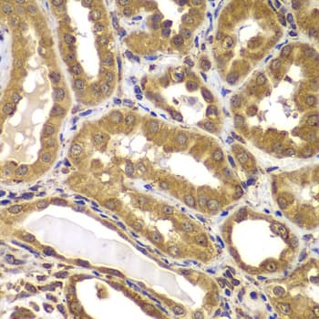Polyclonal Rabbit anti-Human PSEN2 / Presenilin 2 Antibody (IHC, WB)