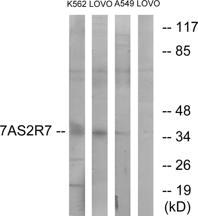 TAS2R7 / T2R7 Antibody (aa47-96)