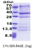 Human DCUN1D4 Protein (Recombinant His)