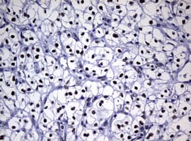 NBN / Nibrin Antibody (clone OTI2E10)