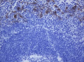 KRT20 / CK20 / Cytokeratin 20 Antibody (aa1-266, clone OTI4A2, Carrier-free)
