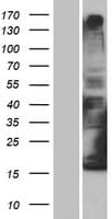 Human DCYTB / CYBRD1 Protein (Over-Expression Lysate Myc-DDK (Flag))