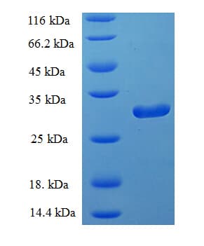 Human PLA2G2D Protein (Recombinant His-SUMO)