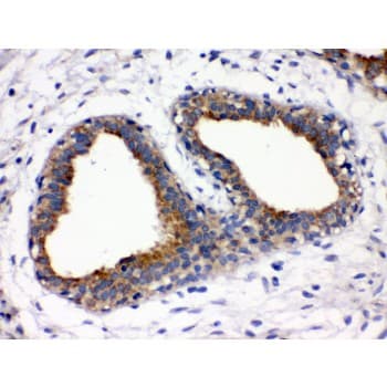 FUT1 / HSC Antibody (aa134-164)