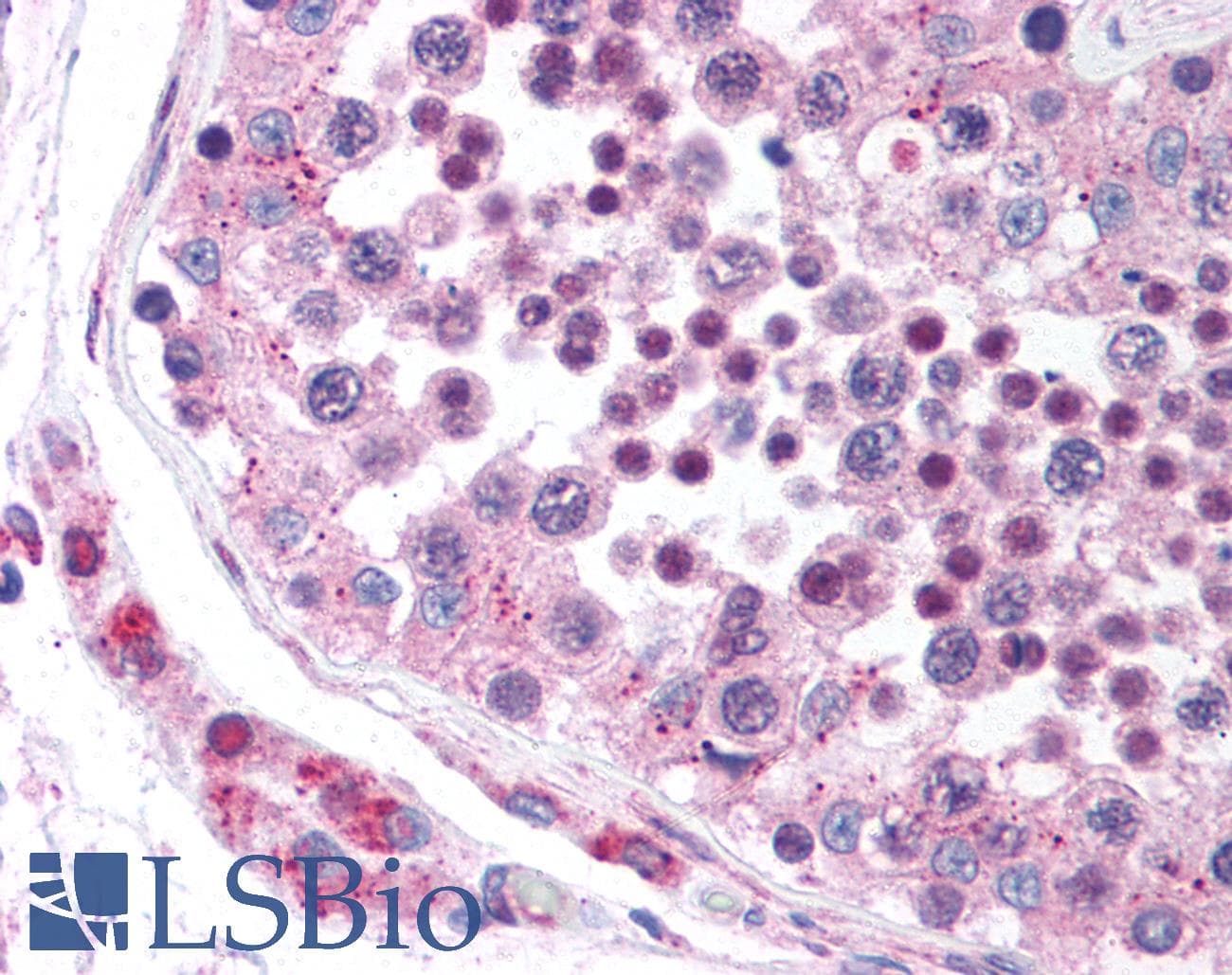 IHC-plus™ DCBLD2 Antibody (aa399-416)