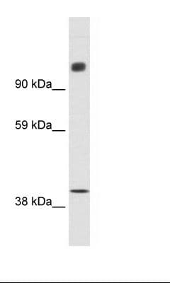 N-CoR / NCOR1 Antibody (aa484-533)