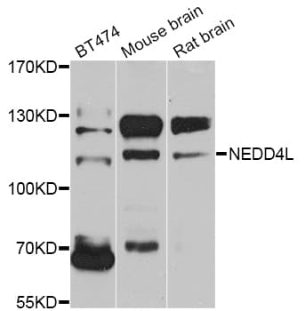 Polyclonal Rabbit anti-Human NEDD4L / NEDD4-2 Antibody (IHC, WB)