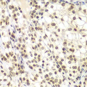 NIRF / UHRF2 Antibody