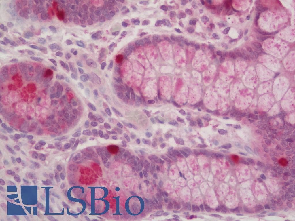 ROR1 Antibody (HRP)