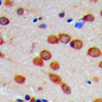 CaMKII Alpha+Delta Antibody (phospho-Thr286)