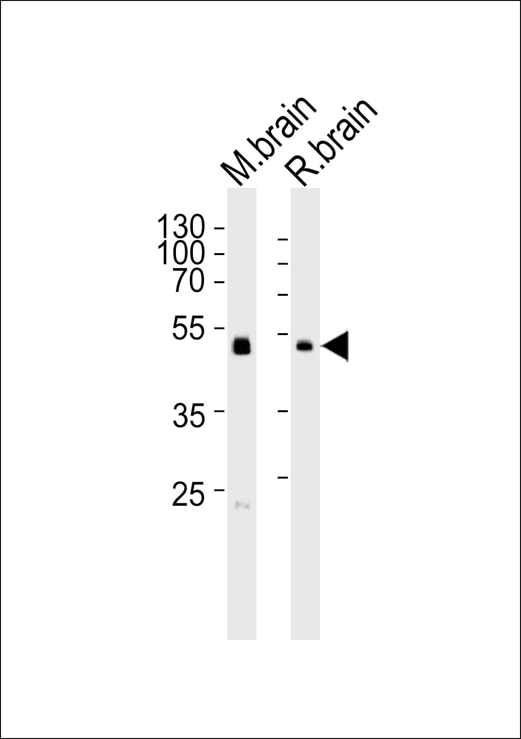 PIP4K2C Antibody (aa23-57)