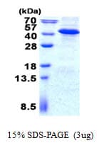 Human IMPAD1 Protein (Recombinant His)