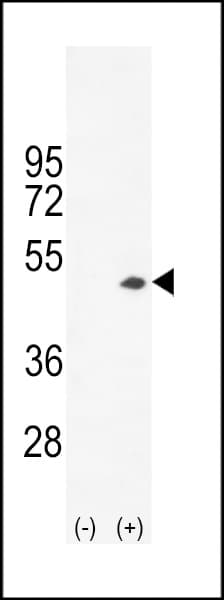 CKB / Creatine Kinase BB Antibody (aa240-270)