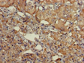 SLU7 / 9G8 Antibody