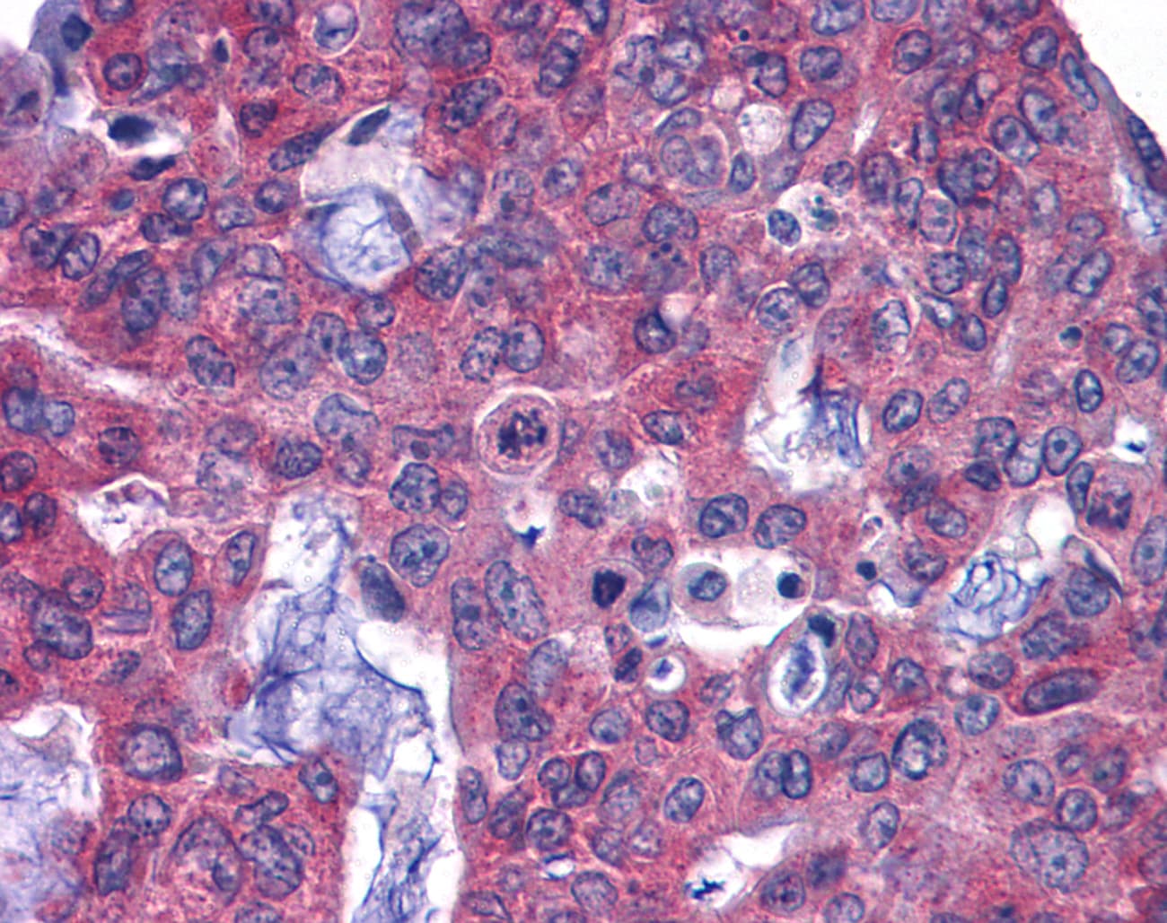 IHC-plus™ GFPT1 / GFAT Antibody (C-Terminus)