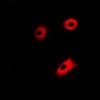 DLD / Diaphorase / E3 Antibody