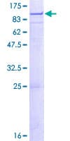 Human Complement C1R Protein (Recombinant GST)