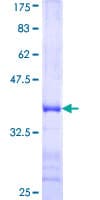Human ARHGEF12 Protein (Recombinant GST, N-terminus)