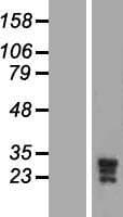 KCNMB3 Protein (Over-Expression Lysate Myc-DDK (Flag))