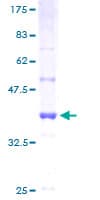 Human ENOPH1 / MASA Protein (Recombinant GST)