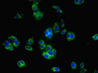Polyclonal Rabbit anti-Human YIF1B Antibody (aa1-153)