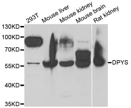DPYS / Dihydropyrimidinase Antibody