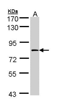IHC-plus™ Polyclonal Rabbit anti-Human F13A1 / Factor XIIIa Antibody (N-Terminus, IHC, WB)