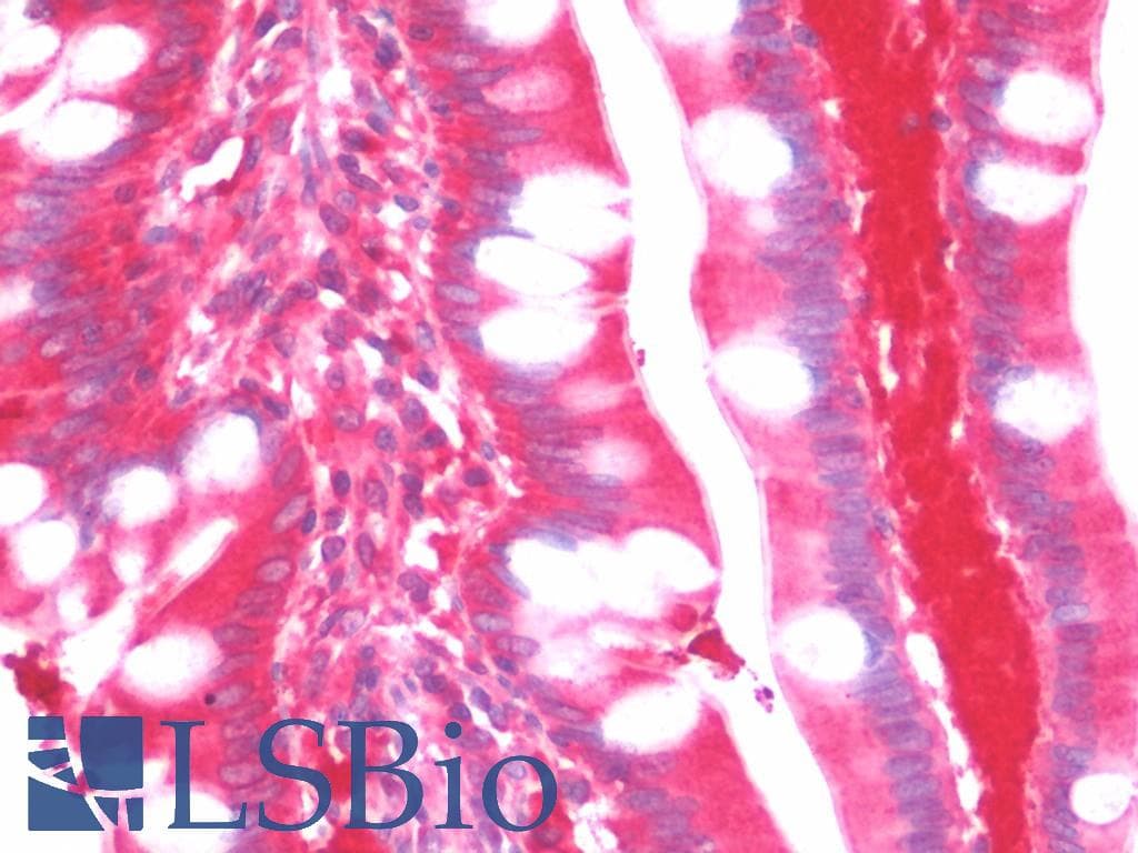 IHC-plus™ Monoclonal Mouse anti-Human TDO2 Antibody (clone 4G2, IHC, WB)