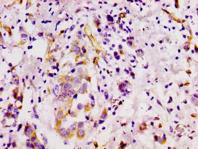 MCAM / CD146 Antibody