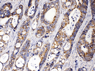 ACAA2 Antibody