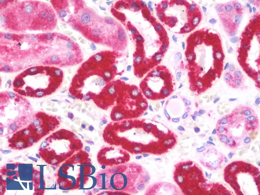 IHC-plus™ NDUFA4L2 Antibody (aa38-87)