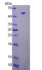 Rat LPL / Lipoprotein Lipase (Recombinant His, N-Terminal)