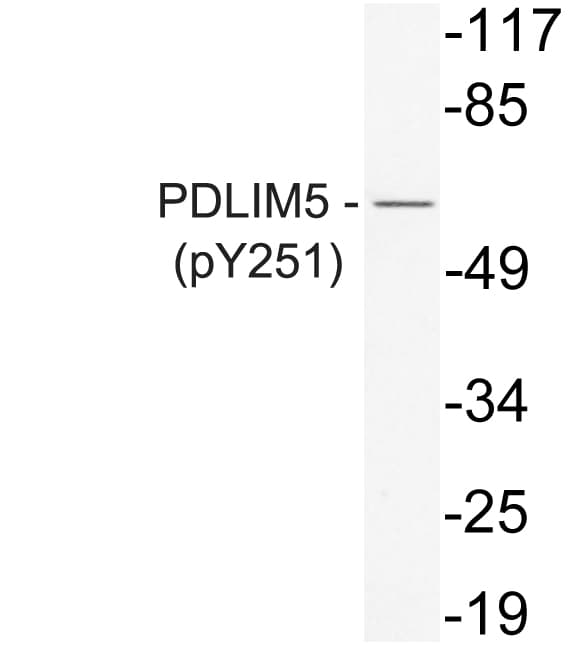 PDLIM5 / LIM Antibody (phospho-Tyr251)