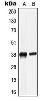 Polyclonal Rabbit anti-Human LRG1 / LRG Antibody (C-Terminus, WB)