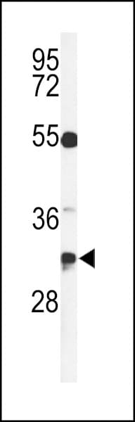 TSPAN7 / CD231 Antibody (aa98-124)