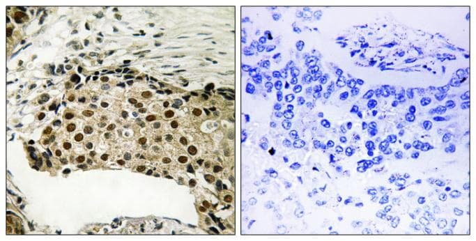 RPS6KA5 / MSK1 Antibody (phospho-Ser212)