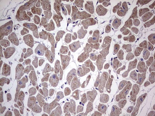 Polyclonal Rabbit anti-Human RELA / NFKB p65 Antibody (aa100-170, IHC, WB)