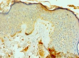 FAP Alpha Antibody (aa26-280)