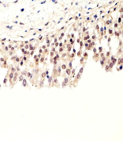 SUMO1 / SMT3 Antibody