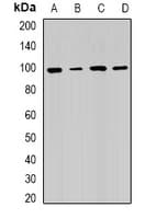 R1 / RRM1 Antibody