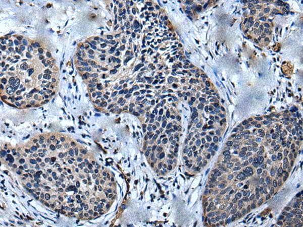 Polyclonal Rabbit anti-Human ULK4 Antibody (IHC)