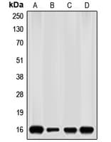 p16INK4a / CDKN2A Antibody (N-Terminus)