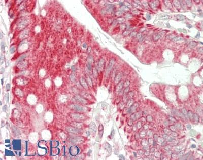 IHC-plus™ Polyclonal Rabbit anti-Human Prostaglandin D2 Receptor Antibody (aa263-312, IHC, IF, WB)