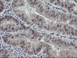 ESRRG / ERR Gamma Antibody (aa24-263, clone OTI1E5)