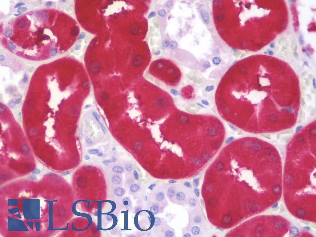 IHC-plus™ ALDOB Antibody (aa111-160)