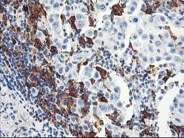 Monoclonal Mouse anti-Human GBP1 Antibody (clone OTI1B2, IHC, IF, WB)