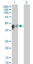 Monoclonal Mouse anti-Human KRT17 / CK17 / Cytokeratin 17 Antibody (clone 2D10, IHC, WB)