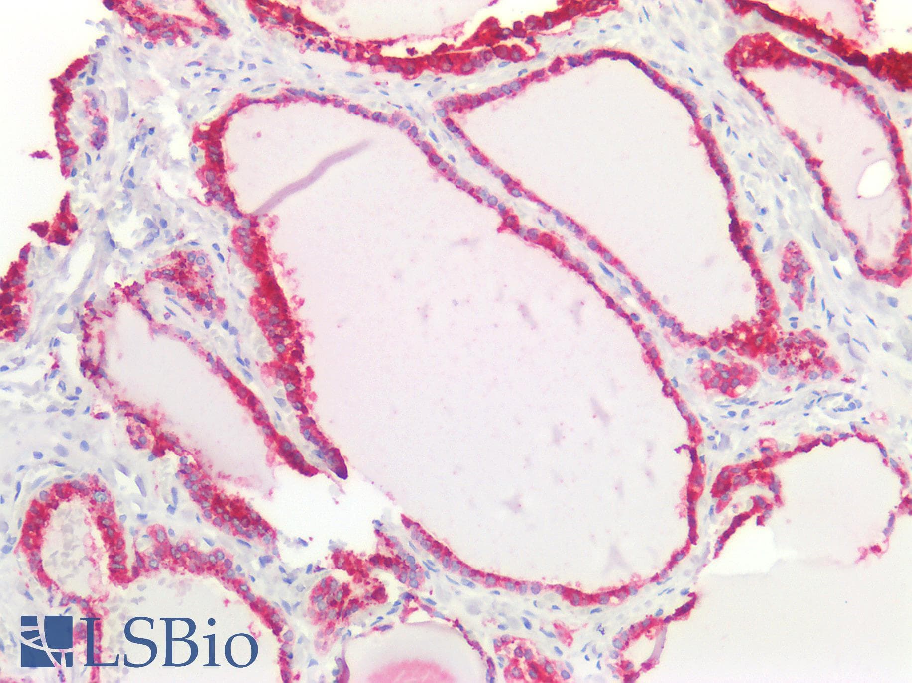 PathPlus™ Polyclonal Rabbit anti-Human CTSB / Cathepsin B Antibody (Internal, IHC, WB)
