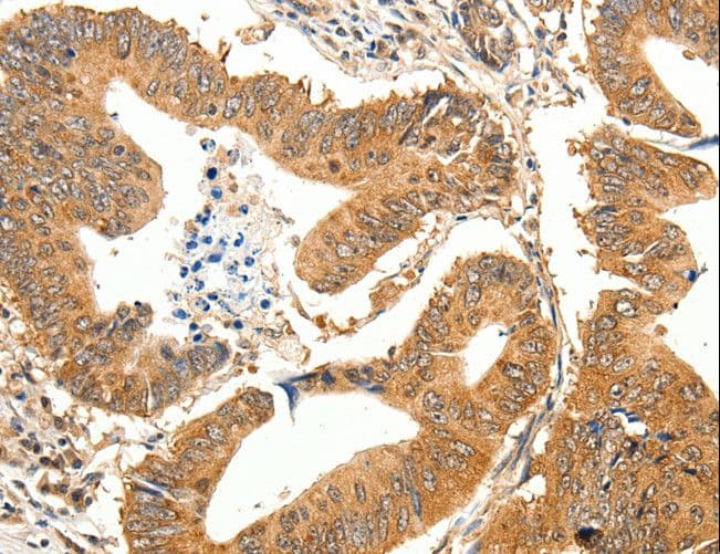 SLC32A1 / VGAT Antibody